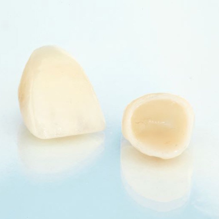 Two dental crowns resting on reflective surface
