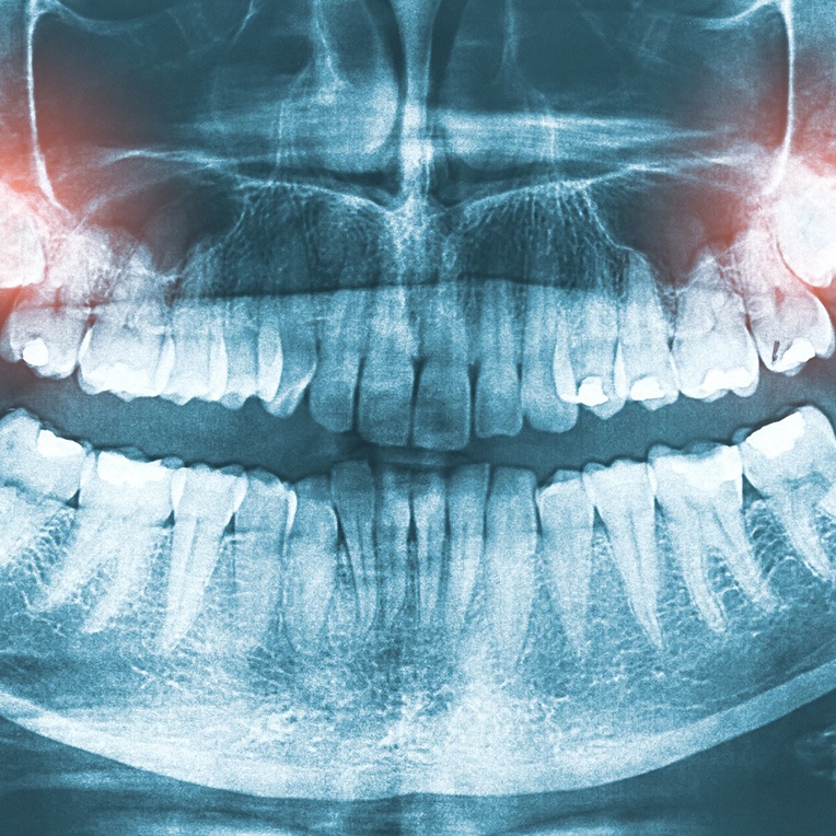 Young man experiencing dental pain	