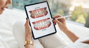 Before and after of patient’s smile displayed on tablet